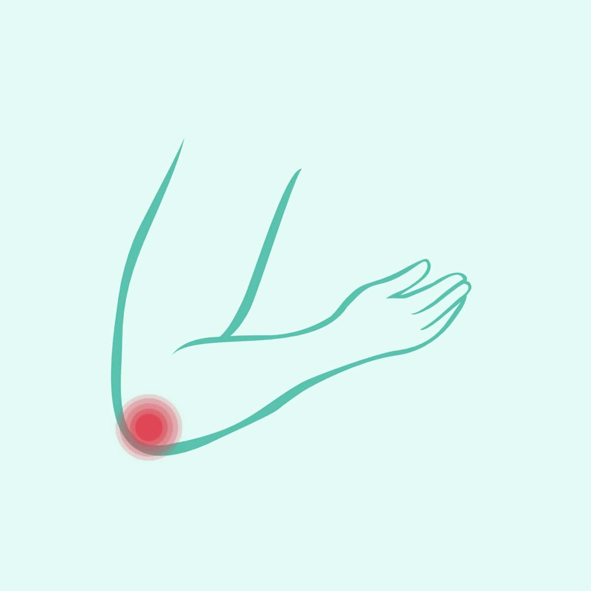 simptomi i liječenje artroze zglobova prsta koksartroza kučnog zgloba 3 stupnja jaka bol