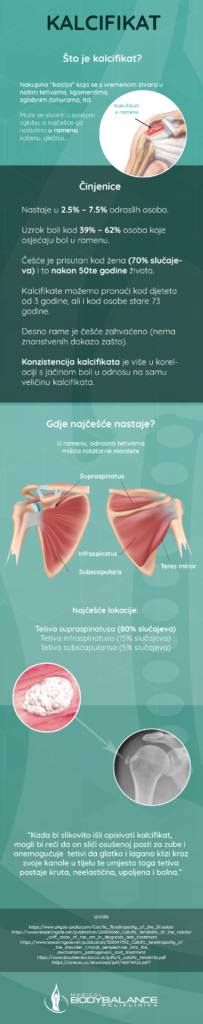 Kako izliječiti kalcifikat? - Poliklinika Medical Body Balance